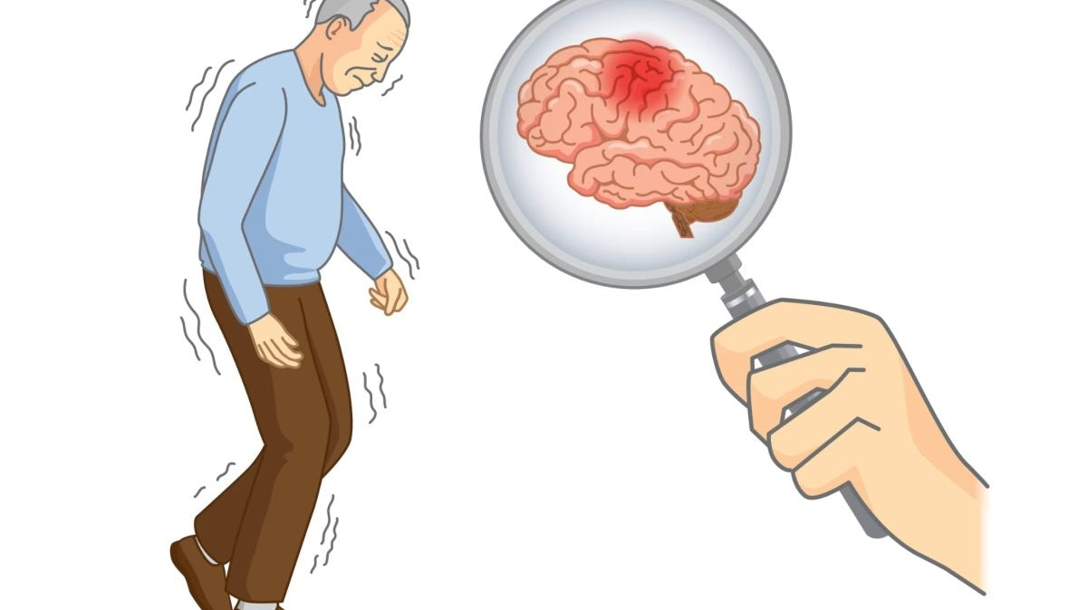 Características neuropsicológicas no Parkinson - IBNeuro