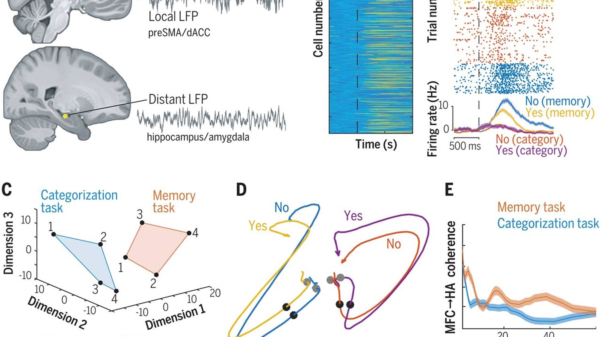 Como o cérebro toma decisões baseadas em memória - IBNeuro