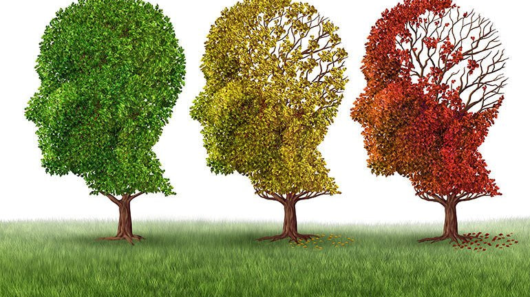 Declínio cognitivo subjetivo (DCS) - IBNeuro