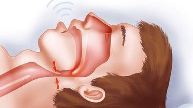 Efeitos da apneia do sono na cognição - IBNeuro