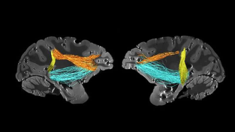 Neuropsicologia da atenção - IBNeuro