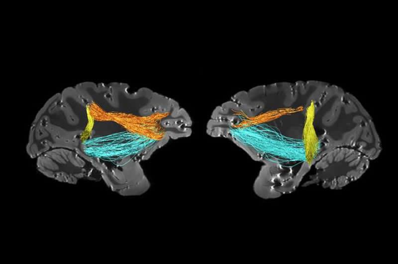 Neuropsicologia da atenção - IBNeuro