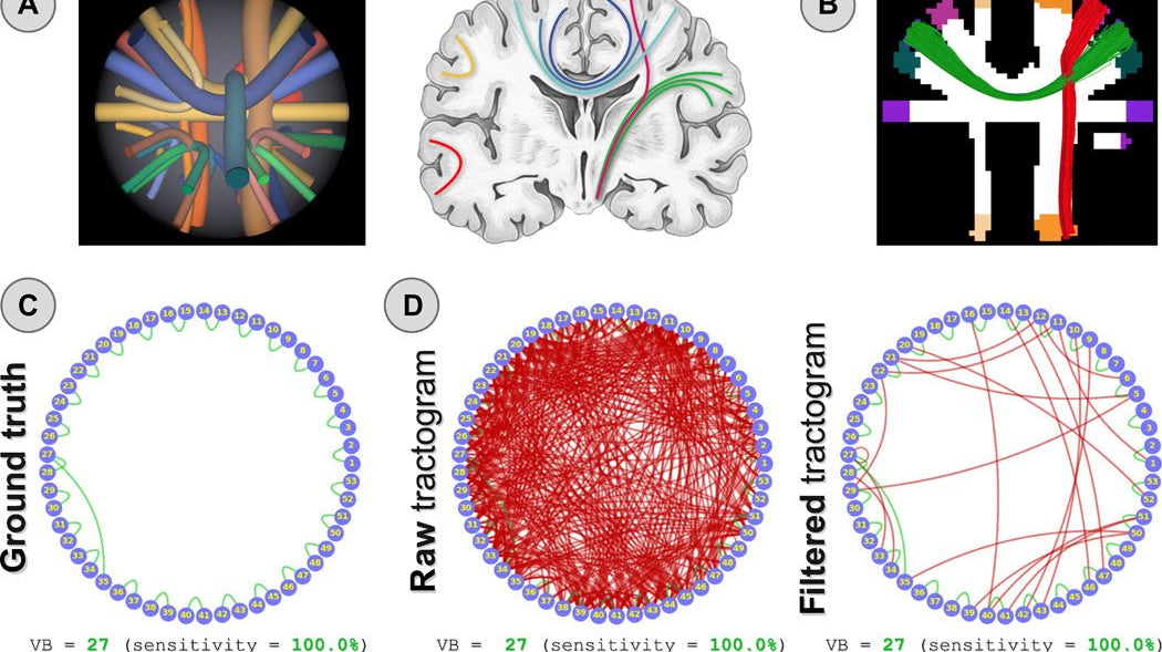 Um novo método para mapeamento de conexões cerebrais usando informações microestruturais e anatômicas - IBNeuro