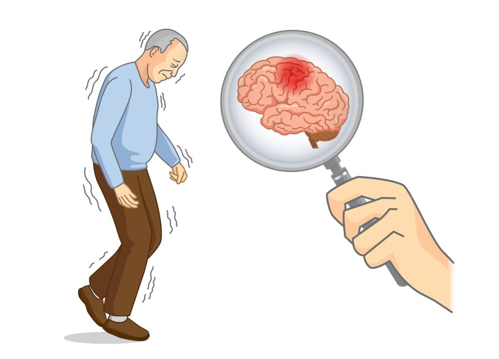 Características neuropsicológicas no Parkinson - IBNeuro