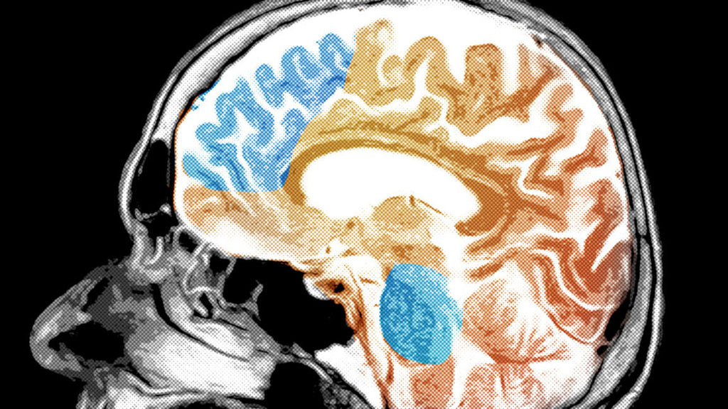 Pesquisadores da Duke University dizem que todo estudo de atividade cerebral que você já leu está errado - IBNeuro