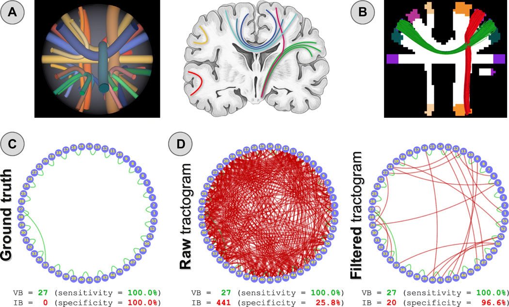 Um novo método para mapeamento de conexões cerebrais usando informações microestruturais e anatômicas - IBNeuro